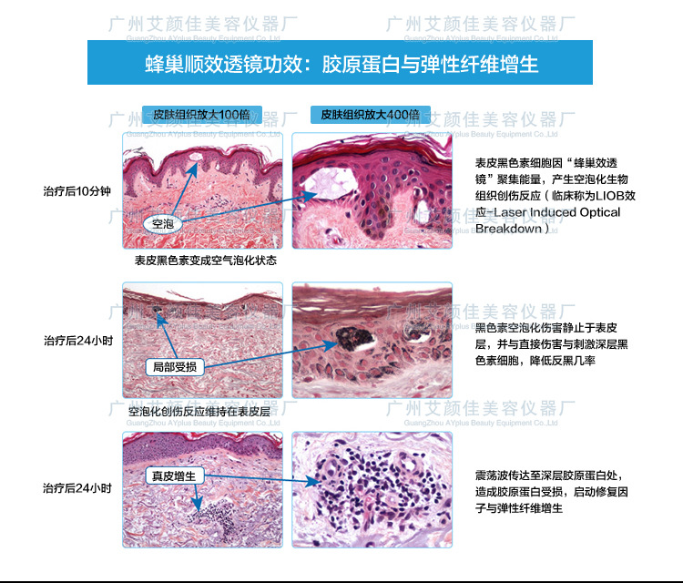 皮秒激光的原理和作用_皮秒激光切割玻璃的原理和工艺研究(2)