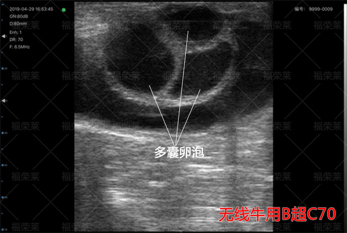 卵泡B超图像