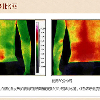 黑龙江牡丹江自发热护腰纯物理温热理疗促进血液循环增加生物能量