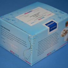 贝类中健忘性贝类毒素残留检测试剂盒