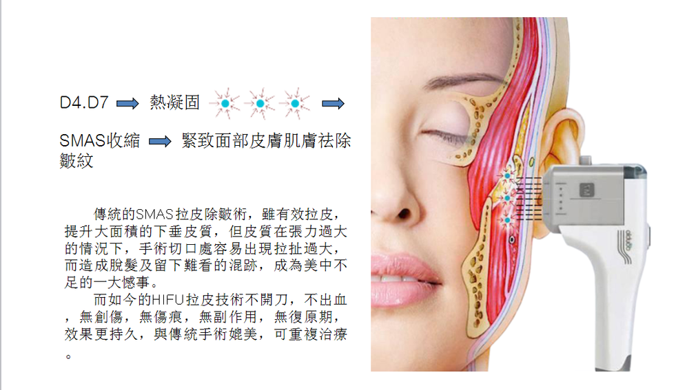 【超声刀祛皱原理】_黄页88网