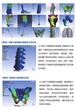 深圳龙华mimicsCT图像处理三维建模培训