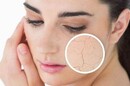 脸部皮肤为什么会干燥缺水的四大原因
