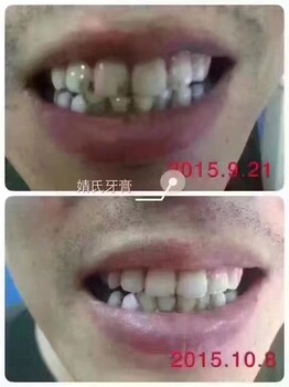 婧氏草本牙膏為什么這么火好不好看反饋就知道