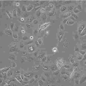 NCM460复苏传代培养细胞系