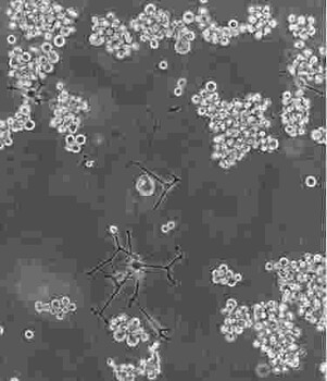 NALM-6贴壁科研细胞系