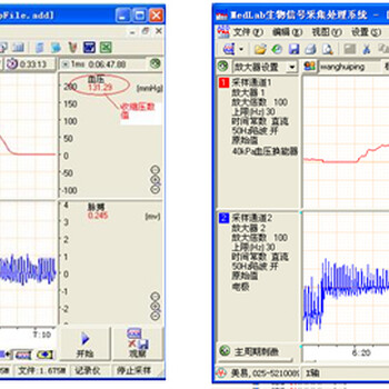 同步反馈系统