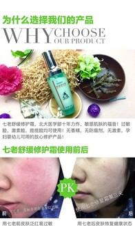 七老舒缓修复霜可以修复敏感肌肤吗？哪里有实体店呀？怎么加盟