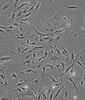 NALM-6复苏类型细胞系