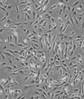 KM-12-SM血清贴壁细胞系图片