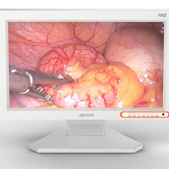 利昂医用内窥镜监视器医用内窥镜监视器国产医用监视器