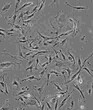 MHCC97H代次更低细胞系图片