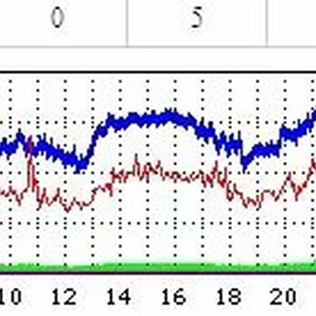 电信G口服务器1000M带宽高防稳定了速度快才有用