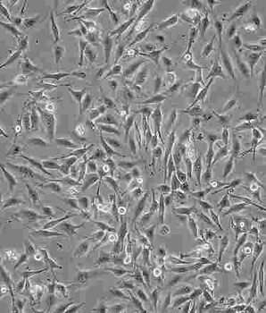 QBC939血清培养细胞系