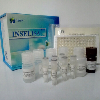 人巨细胞病毒IgM抗体(HCMVIgM)定性检测试剂盒（ELISA）