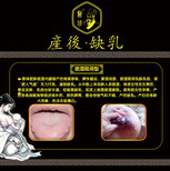 台湾医修乳腺炎溃脓期医修复元汤图片5