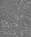SU-DHL-10传代复苏细胞株哪提供图片1