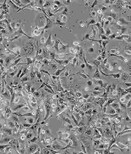 SU-DHL-10传代复苏细胞株哪提供图片0