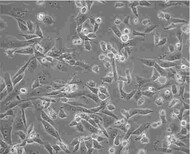 EBTr(NBL-4)贴壁培养细胞株优惠大图片2