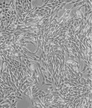 NCI-H1299贴壁培养细胞株优惠大图片0
