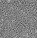 EBTr(NBL-4)传代培养细胞株代次低