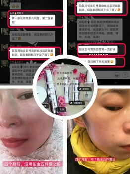 付爱宝铂金时光水眼部精华乳修复精华霜多少钱代理