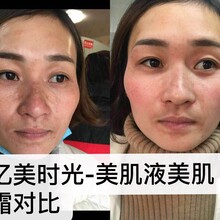 广州嘉怡厂家/广州怡嘉生物科技特色产品--美肌液美肌霜/功效备案厂家