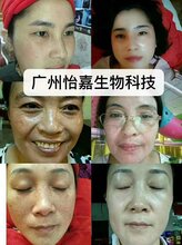 美肌修护精华液,美白,黄褐斑,广州怡嘉生物科技12博12bet开户,oem图片