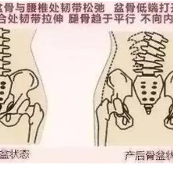 产后康复早知道，避免“笑尿”的尴尬赶紧收藏！