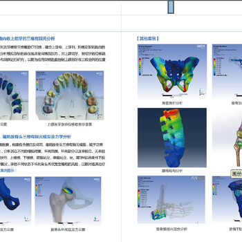 医学有限元分析与处理