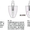 岩石劈裂机