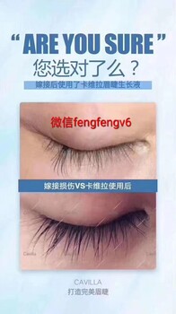 卡维拉董事夏筱沫fengfengv6卡维拉增长液真的可以让我们的睫毛变长吗？孕妇可以用吗