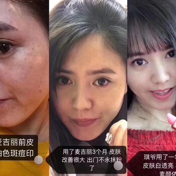 想做麦吉丽代理，可以免费教我怎么推广吗？