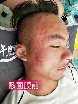 男生可以用溪秀小绿盒面膜吗？怎么卖？代理价多少？