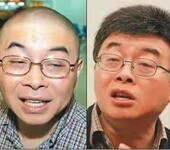 上海男士织发补发价钱多少，定做发块，男士适合纹发吗？