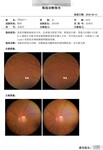 眼部照相图文报告打印功能——泰瑞眼科医生版