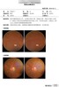 眼部照相图文报告打印功能——泰瑞眼科医生版