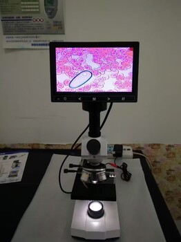 螨虫精子多功能一滴血显微镜检测仪