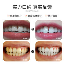 唯爱美牙仪,所谓唇红齿白,你做到了吗图片