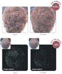 黑发肽乌发肽生发肽棕榈酰四肽-10健康黑发，告别染发伤害
