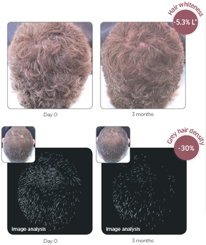 黑发肽乌发肽肽棕榈酰四肽-10健康黑发，告别染发伤害