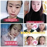 姬存希护肤品价格目录表？姬存希低多少钱代理？图片2