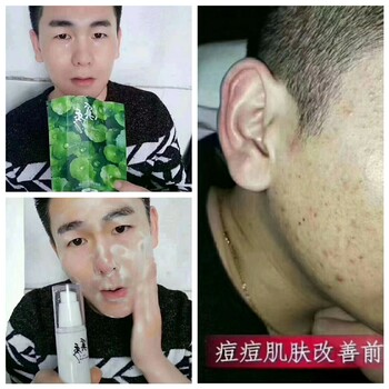 溪秀产品孕妇可以用吗?安全吗?效果怎么样?溪秀面膜怎么代理?