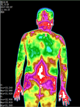热成像的检查项目