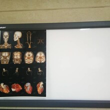 廠家供應X射線膠片超薄雙聯觀片燈ZG-2B圖片