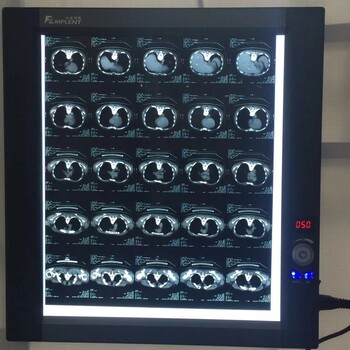 供應(yīng)亮X射線膠片觀片燈LED單聯(lián)觀片燈閱片燈ZG-1