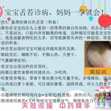 看宝宝舌苔诊病,让宝妈一学就会!图片