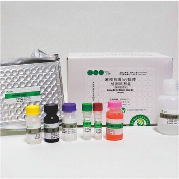 麻疹病毒IgG抗体检测试剂盒（酶联法）