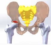 腰椎有限元分析踝关节有限元分析培训