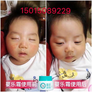 新疆麻哈嬰樂霜戒之館嬰親霜升級版全國代理